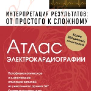 Книга Электрокардиография. Интерпретация результатов 21век